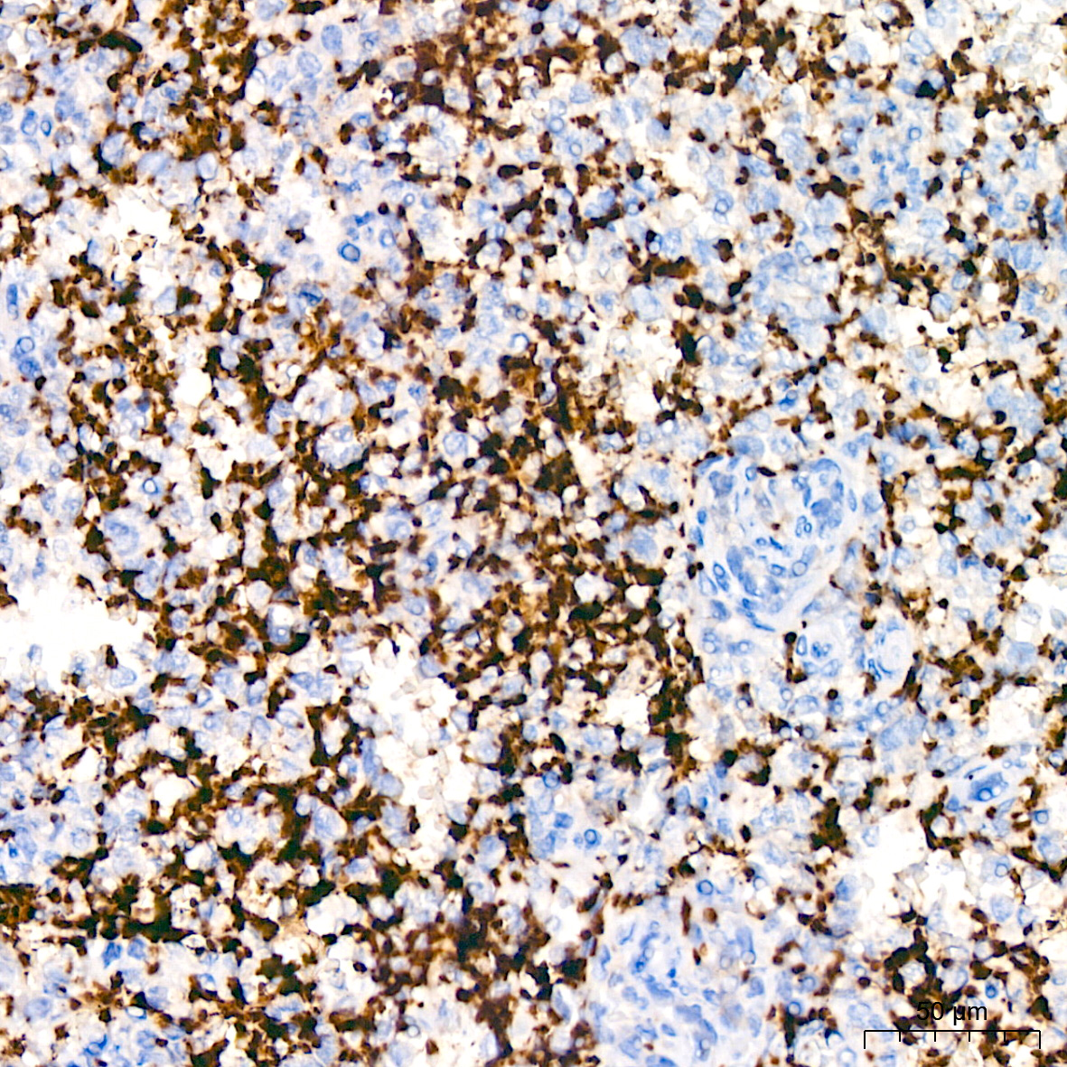 Immunohistochemistry analysis of paraffin-embedded Human spleen tissue using CD42b Rabbit mAb at a dilution of 1:600 (40x lens). High pressure antigen retrieval performed with 0.01M Tris-EDTA Buffer (pH 9.0) prior to IHC staining.