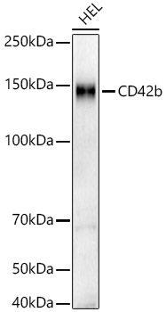 Western blot analysis of lysates from HEL cells, using CD42b Rabbit mAb at  1:2000 dilution.|Secondary antibody: HRP-conjugated Goat anti-Rabbit IgG (H+L) at 1:10000 dilution.|Lysates/proteins: 25μg per lane.|Blocking buffer: 3% nonfat dry milk in TBST.|Detection: ECL Basic Kit.|Exposure time: 180s.