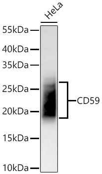 Western blot analysis of lysates from HeLa cells using CD59 Rabbit mAb at 1:5000 dilution incubated overnight at 4℃.|Secondary antibody: HRP-conjugated Goat anti-Rabbit IgG (H+L) at 1:10000 dilution.|Lysates/proteins: 25 μg per lane.|Blocking buffer: 3% nonfat dry milk in TBST.|Detection: ECL Basic Kit.|Exposure time: 20 s.