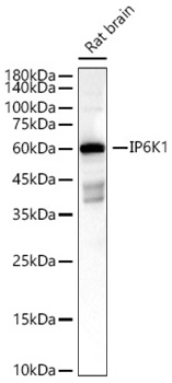 Western blot analysis of various lysates, using IP6K1 Rabbit mAb at1:2000 dilution.|Secondary antibody: HRP-conjugated Goat anti-Rabbit IgG (H+L) at 1:10000 dilution.|Lysates/proteins: 25μg per lane.|Blocking buffer: 3% nonfat dry milk in TBST.|Detection: ECL Basic Kit.|Exposure time: 60 s.