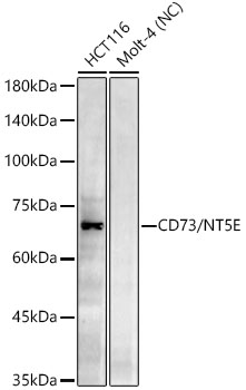 Western blot analysis of various lysates using CD73/NT5E Rabbit mAb at 1:1000 dilution.|Secondary antibody: HRP-conjugated Goat anti-Rabbit IgG (H+L) at 1:10000 dilution.|Lysates/proteins: 25μg per lane.|Blocking buffer: 3% nonfat dry milk in TBST.|Detection: ECL Enhanced Kit.|Negative control (NC): MOLT-4|Exposure time: 45s.