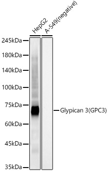 Western blot analysis of various lysates, using Glypican 3 (GPC3) Rabbit mAb at 1:20000 dilution.|Secondary antibody: HRP-conjugated Goat anti-Rabbit IgG (H+L) at 1:10000 dilution.|Lysates/proteins: 25μg per lane.|Blocking buffer: 3% nonfat dry milk in TBST.|Detection: ECL Basic Kit.|Exposure time: 30s.