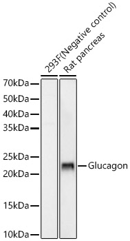 Western blot analysis of various lysates using Glucagon Rabbit mAb at 1:5000 dilution incubated overnight at 4℃.|Secondary antibody: HRP-conjugated Goat anti-Rabbit IgG (H+L) at 1:10000 dilution.|Lysates/proteins: 25μg per lane.|Blocking buffer: 3% nonfat dry milk in TBST.|Detection: ECL Enhanced Kit.|Exposure time: 180s.