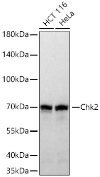 Western blot analysis of various lysates using Chk2 Rabbit mAb at 1:3000 dilution incubated at room temperature for 1.5 hours.|Secondary antibody: HRP-conjugated Goat anti-Rabbit IgG (H+L) at 1:10000 dilution.|Lysates/proteins: 25 μg per lane.|Blocking buffer: 3% nonfat dry milk in TBST.|Detection: ECL Basic Kit.|Exposure time: 90 s.