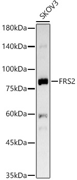 Western blot analysis of lysates from SKOV3 cells, using FRS2 Rabbit mAb at  1:1000 dilution.|Secondary antibody: HRP-conjugated Goat anti-Rabbit IgG (H+L) at 1:10000 dilution.|Lysates/proteins: 25μg per lane.|Blocking buffer: 3% nonfat dry milk in TBST.|Detection: ECL Basic Kit.|Exposure time: 90s.