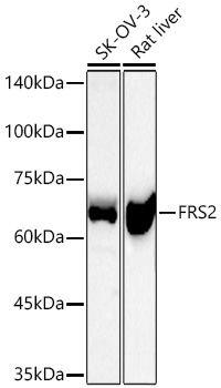 Western blot analysis of various lysates using FRS2 Rabbit mAb at 1:1000 dilution incubated overnight at 4℃.|Secondary antibody: HRP-conjugated Goat anti-Rabbit IgG (H+L) at 1:10000 dilution.|Lysates/proteins: 25 μg per lane.|Blocking buffer: 3% nonfat dry milk in TBST.|Detection: ECL Basic Kit.|Exposure time: 60s.