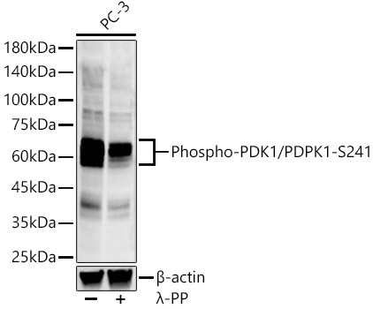 Western blot analysis of various lysates, using Phospho-PDK1/PDPK1-S241 Rabbit mAb at 1:2000 dilution. PC-3 cells were treated by λ-PP mixed solution (1ul) at 30℃ for 30 minutes.|Secondary antibody: HRP-conjugated Goat anti-Rabbit IgG (H+L) at 1:10000 dilution.|Lysates/proteins: 25μg per lane.|Blocking buffer: 3% nonfat dry milk in TBST.|Detection: ECL Enhanced Kit.|Exposure time: 120s.