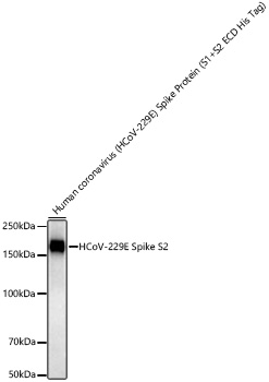Western blot analysis of lysates from Human coronavirus (HCoV-229E) Spike Protein (S1+S2 ECD His Tag) using HCoV-229E Spike S2 Rabbit mAb at 1:3000 dilution incubated at room temperature for 1.5 hours.|Secondary antibody: HRP-conjugated Goat anti-Rabbit IgG (H+L) at 1:10000 dilution.|Lysates/proteins: 100ng per lane.|Blocking buffer: 3% nonfat dry milk in TBST.|Detection: ECL Basic Kit.|Exposure time: 45 s.