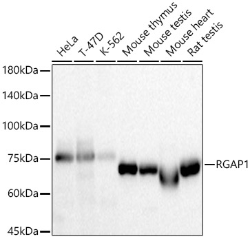 Western blot analysis of various lysates, using [KD Validated] RGAP1 Rabbit mAb at 1:2000 dilution.|Secondary antibody: HRP-conjugated Goat anti-Rabbit IgG (H+L) at 1:10000 dilution.|Lysates/proteins: 25μg per lane.|Blocking buffer: 3% nonfat dry milk in TBST.|Detection: ECL Basic Kit.|Exposure time: 10s.