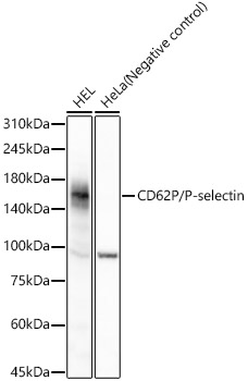 Western blot analysis of various lysates, using CD62P/P-selectin Rabbit mAb at 1:2000 dilution.|Secondary antibody: HRP-conjugated Goat anti-Rabbit IgG (H+L) at 1:10000 dilution.|Lysates/proteins: 25μg per lane.|Blocking buffer: 3% nonfat dry milk in TBST.|Detection: ECL Basic Kit.|Exposure time: 30s.