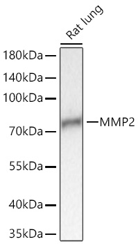 Western blot analysis of lysates from Rat lung using MMP2 Rabbit mAb at 1:5000 dilution incubated overnight at 4℃.|Secondary antibody: HRP-conjugated Goat anti-Rabbit IgG (H+L) at 1:10000 dilution.|Lysates/proteins: 25 μg per lane.|Blocking buffer: 3% nonfat dry milk in TBST.|Detection: ECL Basic Kit.|Exposure time: 90s.