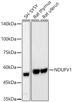 Western blot analysis of various lysates, using NDUFV1 Rabbit mAb at 1:20000 dilution.|Secondary antibody: HRP-conjugated Goat anti-Rabbit IgG (H+L) at 1:10000 dilution.|Lysates/proteins: 25μg per lane.|Blocking buffer: 3% nonfat dry milk in TBST.|Detection: ECL Basic Kit.|Exposure time: 90s.