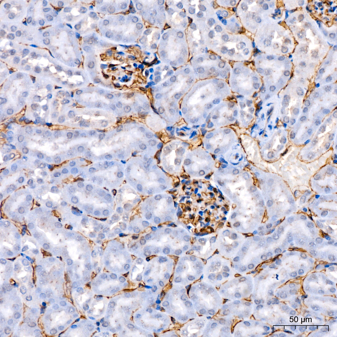 Immunohistochemistry analysis of paraffin-embedded Mouse kidney tissue using Endomucin Rabbit mAb at a dilution of 1:300 (40x lens). High pressure antigen retrieval performed with 0.01M Citrate Buffer (pH 6.0) prior to IHC staining.