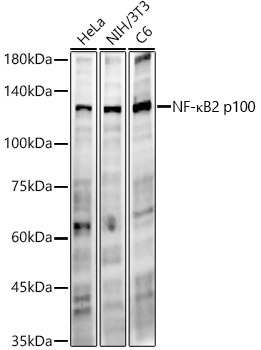 Western blot analysis of various lysates, using NF-κB2 Rabbit mAb at  1:700 dilution.|Secondary antibody: HRP-conjugated Goat anti-Rabbit IgG (H+L) at 1:10000 dilution.|Lysates/proteins: 25μg per lane.|Blocking buffer: 3% nonfat dry milk in TBST.|Detection: ECL Enhanced Kit.|Exposure time: 90s.