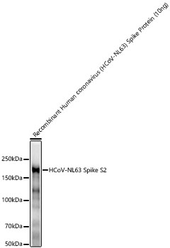 Western blot analysis of recombinant Human coronavirus (HCoV-NL63) Spike Protein (S1+S2 ECD His Tag) using HCoV-NL63 Spike S2 Rabbit mAb at 1:20000 dilution. Secondary antibody: HRP-conjugated Goat anti-Rabbit IgG (H+L) at 1:10000 dilution.|Lysates/proteins: 10ng per lane.|Blocking buffer: 3% nonfat dry milk in TBST.|Detection: ECL Basic Kit.|Exposure time: 60s.