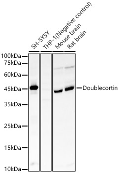 Western blot analysis of various lysates, using Doublecortin Rabbit mAb at 1:7000 dilution.|Secondary antibody: HRP-conjugated Goat anti-Rabbit IgG (H+L) at 1:10000 dilution.|Lysates/proteins: 25μg per lane.|Blocking buffer: 3% nonfat dry milk in TBST.|Detection: ECL Basic Kit.|Exposure time: 180s.