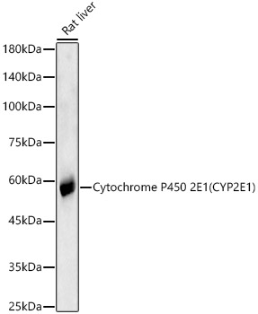 Western blot analysis of lysates from Rat liver, using Cytochrome P450 2E1 (CYP2E1) Rabbit mAb at 1:20000 dilution.|Secondary antibody: HRP-conjugated Goat anti-Rabbit IgG (H+L) at 1:10000 dilution.|Lysates/proteins: 25μg per lane.|Blocking buffer: 3% nonfat dry milk in TBST.|Detection: ECL Basic Kit.|Exposure time: 180s.