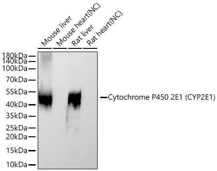 Western blot analysis of various lysates using Cytochrome P450 2E1 (CYP2E1) Rabbit mAb at 1:11000 dilution incubated at room temperature for 1.5 hours.|Secondary antibody: HRP-conjugated Goat anti-Rabbit IgG (H+L) at 1:10000 dilution.|Lysates/proteins: 25 μg per lane.|Blocking buffer: 3% nonfat dry milk in TBST.|Detection: ECL Basic Kit.|Exposure time: 10s.