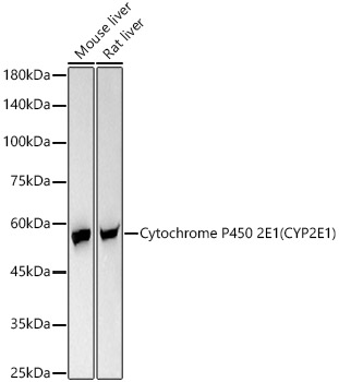 Western blot analysis of various lysates, using Cytochrome P450 2E1 (CYP2E1) Rabbit mAb at 1:10000 dilution.|Secondary antibody: HRP-conjugated Goat anti-Rabbit IgG (H+L) at 1:10000 dilution.|Lysates/proteins: 25μg per lane.|Blocking buffer: 3% nonfat dry milk in TBST.|Detection: ECL Basic Kit.|Exposure time: 180s.