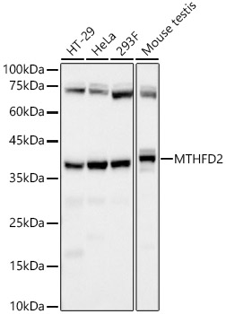 Western blot analysis of various lysates, using MTHFD2 Rabbit mAb at 1:7000 dilution.|Secondary antibody: HRP-conjugated Goat anti-Rabbit IgG (H+L) at 1:10000 dilution.|Lysates/proteins: 25μg per lane.|Blocking buffer: 3% nonfat dry milk in TBST.|Detection: ECL Basic Kit.|Exposure time: 30s.