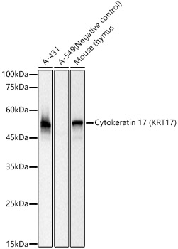 Western blot analysis of various lysates, using Cytokeratin 17 (KRT17) Rabbit mAb at 1:10000 dilution.|Secondary antibody: HRP-conjugated Goat anti-Rabbit IgG (H+L) at 1:10000 dilution.|Lysates/proteins: 25μg per lane.|Blocking buffer: 3% nonfat dry milk in TBST.|Detection: ECL Basic Kit.|Exposure time: 0.5s.