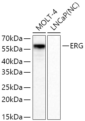 Western blot analysis of various lysates using ERG Rabbit mAb at 1:1000 dilution incubated at room temperature for 1.5 hours.|Secondary antibody: HRP-conjugated Goat anti-Rabbit IgG (H+L) at 1:10000 dilution.|Lysates/proteins: 25 μg per lane.|Blocking buffer: 3% nonfat dry milk in TBST.|Detection: ECL Basic Kit.|Negative control (NC): LNCaP.|Exposure time: 20 s.