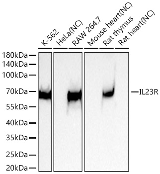 Western blot analysis of various lysates using IL23R Rabbit mAb at 1:5000 dilution incubated overnight at 4℃.|Secondary antibody: HRP-conjugated Goat anti-Rabbit IgG (H+L) at 1:10000 dilution.|Lysates/proteins: 25 μg per lane.|Blocking buffer: 3% nonfat dry milk in TBST.|Detection: ECL Basic Kit.|Negative control (NC): HeLa,Mouse heart,Rat heart|Exposure time: 20s.