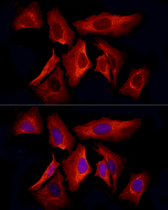 Immunofluorescence analysis of HeLa cells using Cytokeratin 8 (KRT8) Rabbit mAb at dilution of 1:200 (40x lens). Secondary antibody: Cy3-conjugated Goat anti-Rabbit IgG (H+L) at 1:500 dilution. Blue: DAPI for nuclear staining.