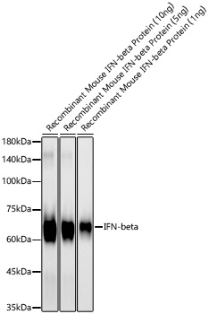 Western blot analysis of Recombinant Mouse IFN-beta Protein  using IFN-beta Rabbit mAb at  1:6000 dilution.|Secondary antibody: HRP-conjugated Goat anti-Rabbit IgG (H+L) at 1:10000 dilution.|Lysates/proteins: 10ng/5ng/1ng per lane.|Blocking buffer: 3% nonfat dry milk in TBST.|Detection: ECL Basic Kit.|Exposure time: 30s.