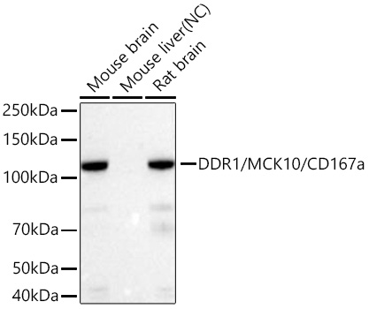 Western blot analysis of various lysates using DDR1/MCK10/CD167a Rabbit mAb at 1:1000 dilution incubated at room temperature for 1.5 hours.|Secondary antibody: HRP-conjugated Goat anti-Rabbit IgG (H+L) at 1:10000 dilution.|Lysates/proteins: 25 μg per lane.|Blocking buffer: 3% nonfat dry milk in TBST.|Detection: ECL Basic Kit.|Negative control (NC): Mouse liver|Exposure time: 60s.