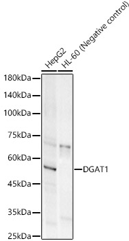Western blot analysis of various lysates, using DGAT1 Rabbit mAb at  1:1000 dilution.|Secondary antibody: HRP-conjugated Goat anti-Rabbit IgG (H+L) at 1:10000 dilution.|Lysates/proteins: 25μg per lane.|Blocking buffer: 3% nonfat dry milk in TBST.|Detection: ECL Basic Kit.|Exposure time: 180s.