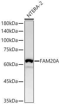 Western blot analysis of lysates from NTERA-2 cells using FAM20A Rabbit mAb at 1:20000 dilution incubated overnight at 4℃.|Secondary antibody: HRP-conjugated Goat anti-Rabbit IgG (H+L) at 1:10000 dilution.|Lysates/proteins: 25 μg per lane.|Blocking buffer: 3% nonfat dry milk in TBST.|Detection: ECL Basic Kit.|Exposure time: 180 s.