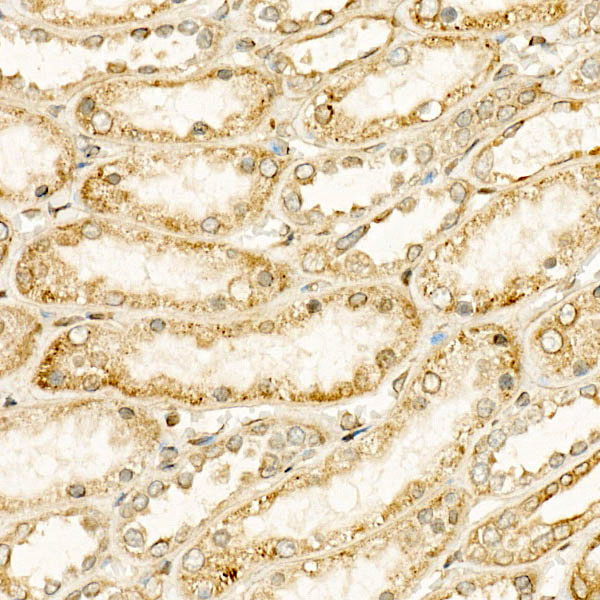Immunohistochemistry analysis of paraffin-embedded Human kidney using CYP24A1 Rabbit mAb at dilution of 1:400 (40x lens). High pressure antigen retrieval performed with 0.01M Citrate buffer (pH 6.0) prior to IHC staining.