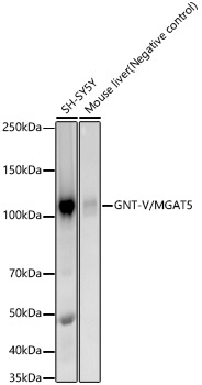 Western blot analysis of various lysates, using GNT-V/MGAT5 Rabbit mAb at  1:1000 dilution.|Secondary antibody: HRP-conjugated Goat anti-Rabbit IgG (H+L) at 1:10000 dilution.|Lysates/proteins: 25μg per lane.|Blocking buffer: 3% nonfat dry milk in TBST.|Detection: ECL Enhanced Kit.|Exposure time: 180s.