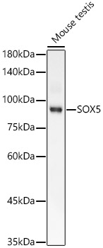 Western blot analysis of lysates from Mouse testis, using SOX5 Rabbit mAb at 1:2000 dilution.|Secondary antibody: HRP-conjugated Goat anti-Rabbit IgG (H+L) at 1:10000 dilution.|Lysates/proteins: 25μg per lane.|Blocking buffer: 3% nonfat dry milk in TBST.|Detection: ECL Basic Kit.|Exposure time: 60s.