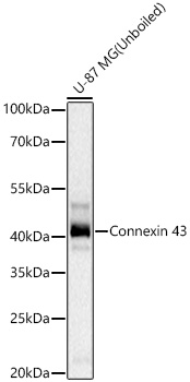 Western blot analysis of lysates from U-87 MG cells using Connexin 43 Rabbit mAb at 1:1000 dilution incubated at room temperature for 1.5 hours.|Secondary antibody: HRP-conjugated Goat anti-Rabbit IgG (H+L) at 1:10000 dilution.|Lysates/proteins: 25 μg per lane.|Blocking buffer: 3% nonfat dry milk in TBST.|Detection: ECL Basic Kit.|Exposure time: 5 s.
