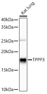 Western blot analysis of various lysates using TPPP3 Rabbit mAb at 1:1000 dilution.|Secondary antibody: HRP-conjugated Goat anti-Rabbit IgG (H+L) at 1:10000 dilution.|Lysates/proteins: 25 μg per lane.|Blocking buffer: 3% nonfat dry milk in TBST.|Detection: ECL Basic Kit.|Exposure time: 60s.