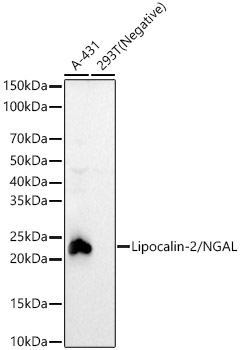 Western blot analysis of various lysates, using Lipocalin-2/NGAL Rabbit mAb at 1:5000 dilution.|Secondary antibody: HRP-conjugated Goat anti-Rabbit IgG (H+L) at 1:10000 dilution.|Lysates/proteins: 25μg per lane.|Blocking buffer: 3% nonfat dry milk in TBST.|Detection: ECL Basic Kit.|Exposure time: 60s.