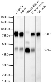 Western blot analysis of various lysates, using [KD Validated] GALC Rabbit mAb at 1:1000 dilution.|Secondary antibody: HRP-conjugated Goat anti-Rabbit IgG (H+L) at 1:10000 dilution.|Lysates/proteins: 25μg per lane.|Blocking buffer: 3% nonfat dry milk in TBST.|Detection: ECL Basic Kit.|Exposure time: 30s.