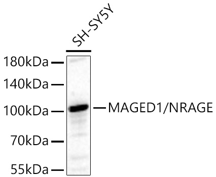 Western blot analysis of lysates from SH-SY5Y cells using MAGED1/NRAGE Rabbit mAb at 1:2000 dilution incubated overnight at 4℃.|Secondary antibody: HRP-conjugated Goat anti-Rabbit IgG (H+L) at 1:10000 dilution.|Lysates/proteins: 25 μg per lane.|Blocking buffer: 3% nonfat dry milk in TBST.|Detection: ECL Basic Kit.|Exposure time: 90 s.