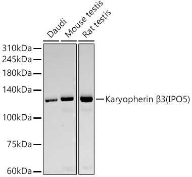 Western blot analysis of various lysates, using Karyopherin β3 (IPO5) Rabbit mAb at  1:10000 dilution.|Secondary antibody: HRP-conjugated Goat anti-Rabbit IgG (H+L) at 1:10000 dilution.|Lysates/proteins: 25μg per lane.|Blocking buffer: 3% nonfat dry milk in TBST.|Detection: ECL Basic Kit.|Exposure time: 180s.