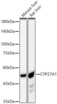 Western blot analysis of various lysates, using CYP27A1 Rabbit mAb at 1:5000 dilution.|Secondary antibody: HRP-conjugated Goat anti-Rabbit IgG (H+L) at 1:10000 dilution.|Lysates/proteins: 25μg per lane.|Blocking buffer: 3% nonfat dry milk in TBST.|Detection: ECL Basic Kit.|Exposure time: 30s.