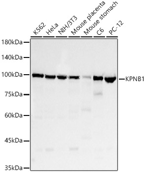Western blot analysis of various lysates, using KPNB1 Rabbit mAb at 1:10000 dilution.|Secondary antibody: HRP-conjugated Goat anti-Rabbit IgG (H+L) at 1:10000 dilution.|Lysates/proteins: 25μg per lane.|Blocking buffer: 3% nonfat dry milk in TBST.|Detection: ECL Basic Kit.|Exposure time: 30s.
