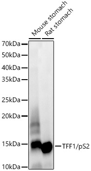 Western blot analysis of various lysates, using TFF1/pS2 Rabbit mAb at 1:1000 dilution.|Secondary antibody: HRP-conjugated Goat anti-Rabbit IgG (H+L) at 1:10000 dilution.|Lysates/proteins: 25μg per lane.|Blocking buffer: 3% nonfat dry milk in TBST.|Detection: ECL Enhanced Kit.|Exposure time: 60s.