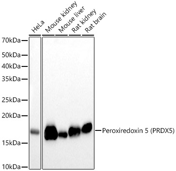 Western blot analysis of various lysates, using [KO Validated] Peroxiredoxin 5 (PRDX5) Rabbit mAb at 1:1000 dilution.|Secondary antibody: HRP-conjugated Goat anti-Rabbit IgG (H+L) at 1:10000 dilution.|Lysates/proteins: 25μg per lane.|Blocking buffer: 3% nonfat dry milk in TBST.|Detection: ECL Basic Kit.|Exposure time: 30s.