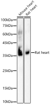 Western blot analysis of various lysates using COX1 Rabbit mAb at 1:1000 dilution incubated overnight at 4℃.|Secondary antibody: HRP-conjugated Goat anti-Rabbit IgG (H+L) at 1:10000 dilution.|Lysates/proteins: 25 μg per lane.|Blocking buffer: 3% nonfat dry milk in TBST.|Detection: ECL Basic Kit.|Exposure time: 1 s.