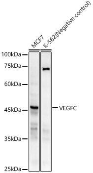 Western blot analysis of various lysates, using VEGFC Rabbit mAb at 1:1000 dilution.|Secondary antibody: HRP-conjugated Goat anti-Rabbit IgG (H+L) at 1:10000 dilution.|Lysates/proteins: 25μg per lane.|Blocking buffer: 3% nonfat dry milk in TBST.|Detection: ECL Basic Kit.|Exposure time: 180s.