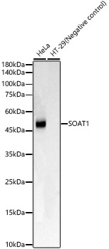 Western blot analysis of various lysates, using SOAT1 Rabbit mAb at 1:1000 dilution.|Secondary antibody: HRP-conjugated Goat anti-Rabbit IgG (H+L) at 1:10000 dilution.|Lysates/proteins: 25μg per lane.|Blocking buffer: 3% nonfat dry milk in TBST.|Detection: ECL Basic Kit.|Negative control (NC): HT-29|Exposure time: 30s.