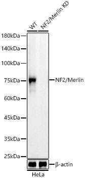 Western blot analysis of lysates from wild type(WT) and NF2/Merlin knockdown (KD) HeLa cells, using [KD Validated] NF2/Merlin Rabbit mAb at 1:2000 dilution.|Secondary antibody: HRP-conjugated Goat anti-Rabbit IgG (H+L) at 1:10000 dilution.|Lysates/proteins: 25μg per lane.|Blocking buffer: 3% nonfat dry milk in TBST.|Detection: ECL Basic Kit.|Exposure time: 90s.