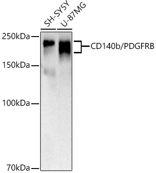 Western blot analysis of various lysates, using CD140b/PDGFRB Rabbit mAb at 1:2000 dilution.|Secondary antibody: HRP-conjugated Goat anti-Rabbit IgG (H+L) at 1:10000 dilution.|Lysates/proteins: 25μg per lane.|Blocking buffer: 3% nonfat dry milk in TBST.|Detection: ECL Basic Kit.|Exposure time: 30s.